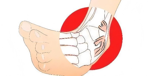 踝關(guān)節(jié)扭傷后的最佳應(yīng)對指南：簡單四步，助力快速康復(fù)！